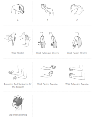 Exercises After Wrist Fracture Dr Shreedhar Archik